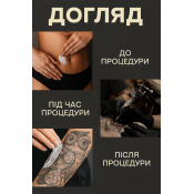 Уход